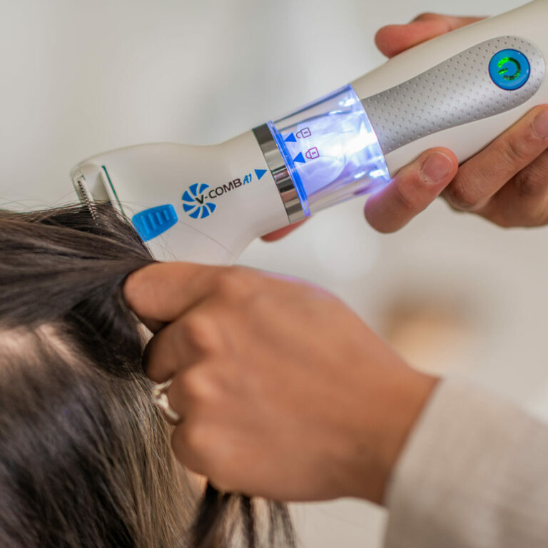 Licetec V-Comb A1 bežični češalj/usisavač za uši i gnjide